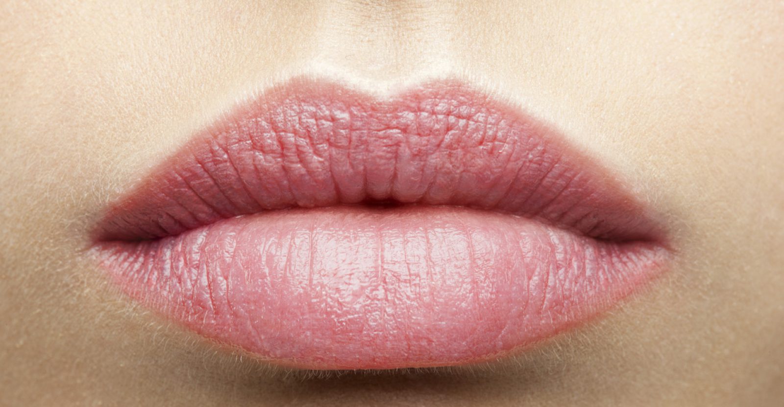 Nie wieder aufgesprungene Lippen! Hausmittel gegen trockene Lippen